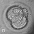 4.2.2. Partenotların Işık Mikroskobik Değerlendirilmesi Daha önce partenotlar için yapılmış herhangi bir kalitelendirme sistemi olmadığı için embriyolar için kullanılan üç kriter (blastomer boyutu ve
