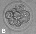 4.2.2.3. Partenot: Sekiz Hücreli Evre Sekiz hücreli partenotlar, düzgün ZP ve blastomer yapısı ile eşit şekil ve büyüklükteki sekiz adet blastomerlere sahip olup, fragmentasyon içermiyorlarsa 1.