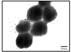 Nanopartiküllerin Çalışması A. Ferromanyetik bir nanopartikül insan immoglonulini G (IgC) ile fonksiyonelleştirilerek insan vücudunda stafillokokkus protein zarına bağlanması sağlanır.