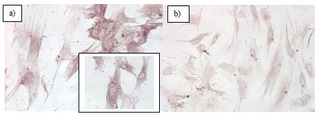 Ayrıca eş zamanlı olarak MKH lerde apoptozis gerçekleşip gerçekleşmediğini görmek, apoptozisin WNT sinyal yolağıyla bağlantısı olup olmadığını anlamak amacıyla Bcl-2, Bax ve Kaspaz 3 proteinleri için