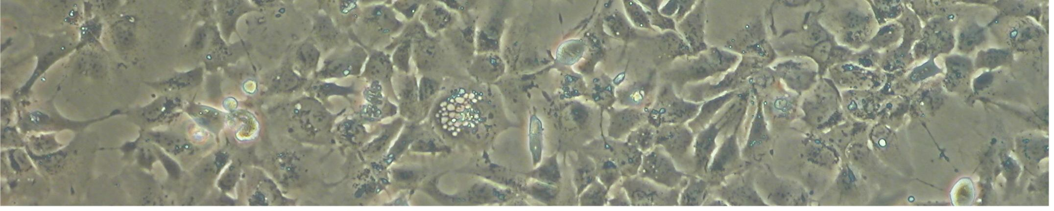 2.2.3.4. Çalışmada Kullanılan Hücre Soyu Çalışmada insan hepatoma hücre hattı Hep3B kullanıldı. Şekil 2. 11: Hep3B hücrelerinin faz-kontrast mikroskobu ile görüntülenmesi 2.2.3.5.