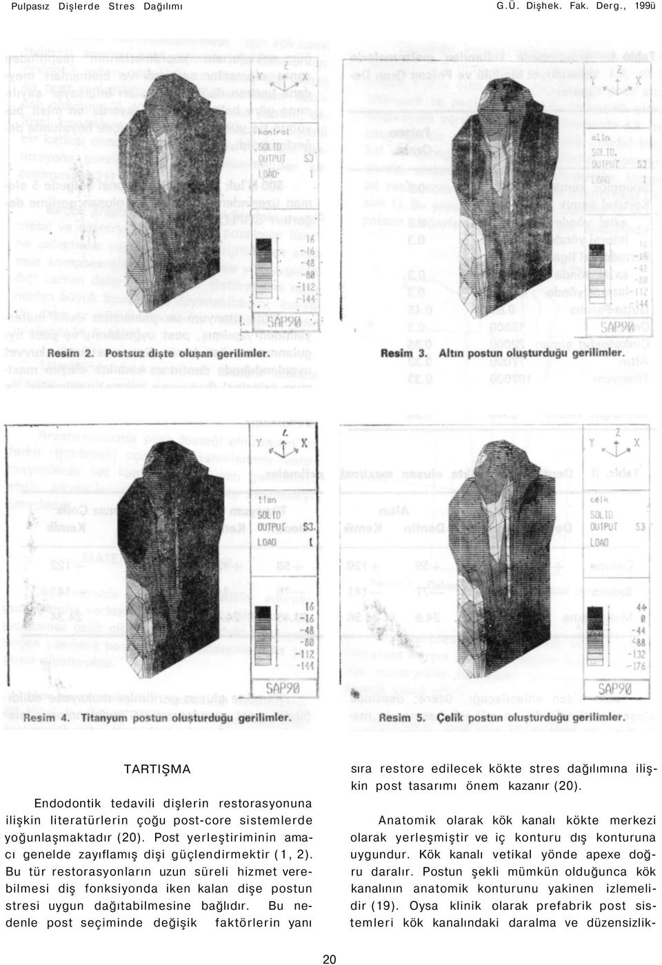 Bu tür restorasyonların uzun süreli hizmet verebilmesi diş fonksiyonda iken kalan dişe postun stresi uygun dağıtabilmesine bağlıdır.