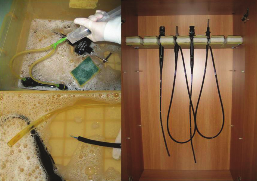 Safety of Patients and Equipment in Bronchoscopy Suite uygun fırçayla fırçalanarak temizlenmelidir.