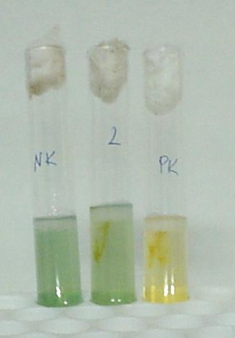 4.BULGULAR VE TARTIŞMA Şekil 4.13.Oksijensiz ortamda gelişme gösteren (sağda) ve göstermeyen (soldan ilk iki) bakteri kültürleri 4.4.5.