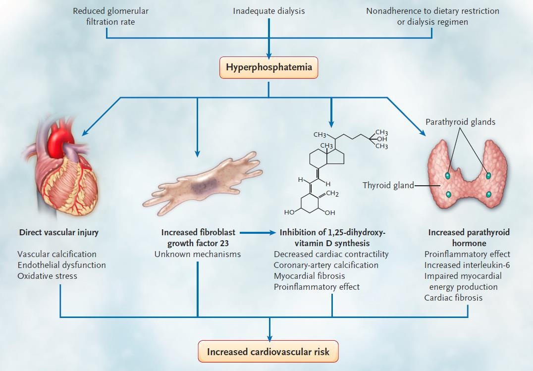 Hiperfosfatemi ve Kardiyovasküler Risk