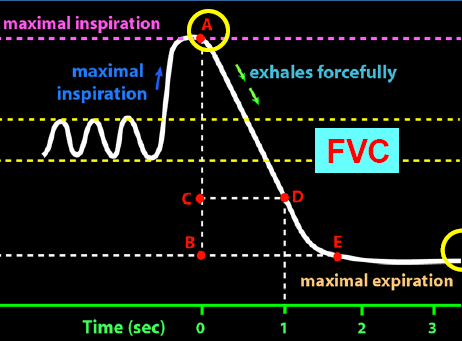 Zorlu vital kapasite (FVC) Tam bir inspirasyondan sonra zorlu ve hızlı ekspirasyonla
