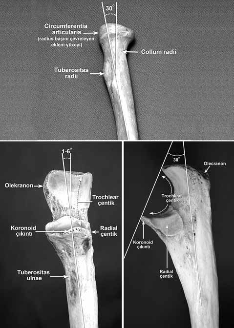 Dirsek eklemi anatomisi ve instabilitesi bulunabilir. Bu bant bulunduğunda korakobrakiyalis kasına (m. coracobrachialis) anormal sonlanma ve pronator teres e (m.