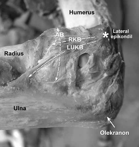 Dirsek eklemi anatomisi ve instabilitesi 11 Şekil 6. Sağ dirsek ekleminin medialden görünümü.