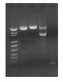 1 2 3 4 5 535 bp (ß2-microglobulin) 353 bp (b3a2) Fig 1. 3% agarose gel electrophoresis of nested PCR products. 1. DNA Molecular Weight Marker 2.