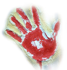 Hand Microsurgery & Özgün Araştırma / Original Research Hand Microsurg 2014;3:1-7 doi:10.5455/handmicrosurg.
