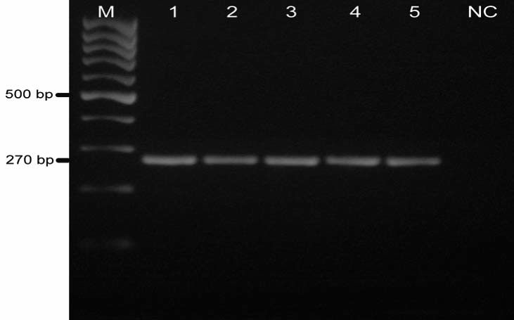 613 HADİMLİ, ERGANİŞ KAV, SAYIN aşaması ile amplifikasyon tamamlandı 17. PCR ürünlerinden 10 µl miktarı horizontal elektroforez de ethidium bromid li (0.5 mg/ml) %1.