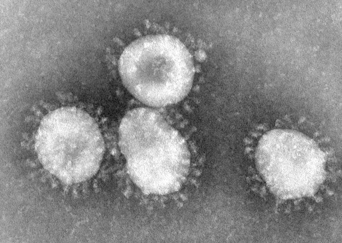 Coronavirüsler Tek iplikli RNA virusu, Coronaviridae ailesinden Damlacık ve enfekte tozlarla bulaş Uzun süredir üst solunum yolu enfeksiyonundan sorumluyken, 2003, SARS pandemisiyle ciddi pnömoni,