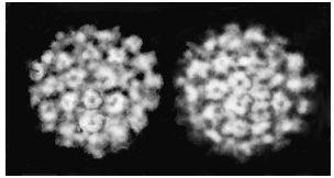 PAPILLOMA VIRÜSLER Papilla (nipple) + oma(tumour) Sadece differansiye skuamöz epitel hücre nükleusunda replike olan zarfsız, DNA