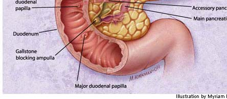 Anatomi-Fizyopatoloji Safra hepatositlerde üretilir ve depo için safra kesesine taşınır Safra kanalları giderek birleşir ve büyür,sağ ve sol hepatik kanalı oluşturur Ortak hepatik kanalda sistik