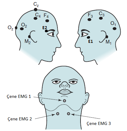 Montaj Elektroensefalogram (Santral ve oksipital EEG), referans elekrotlar (M1 ve
