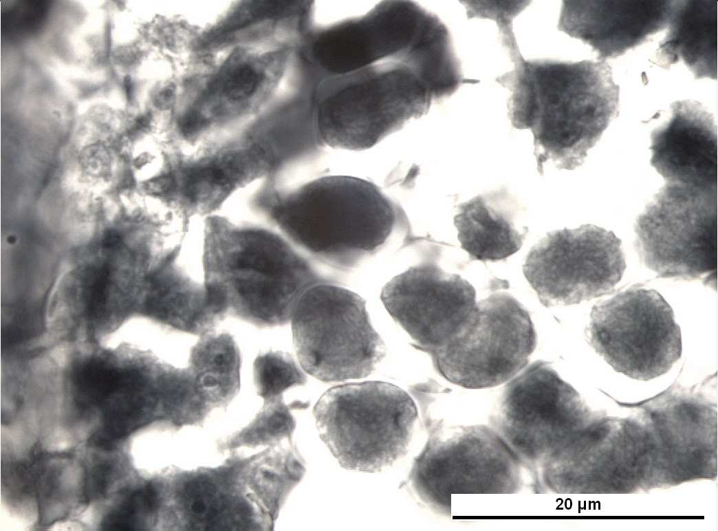 9) Telofaz-II nin ardından Sitokinez gerçekleşir. Kromozom durumu haploid (n) olan dört hücre meydana gelmiş olur. Bu hücreler, mikrospor ana hücresinden oluşan mikrosporlardır.