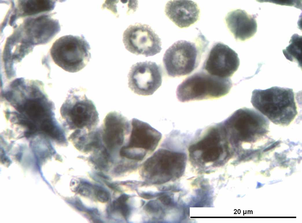 11 Vitis vinifera L. cv. Uslu anterlerindeki polen ana hücrelerinde çekirdeklerde çekirdekçik sayılarındaki artış Bar = 20 µm.