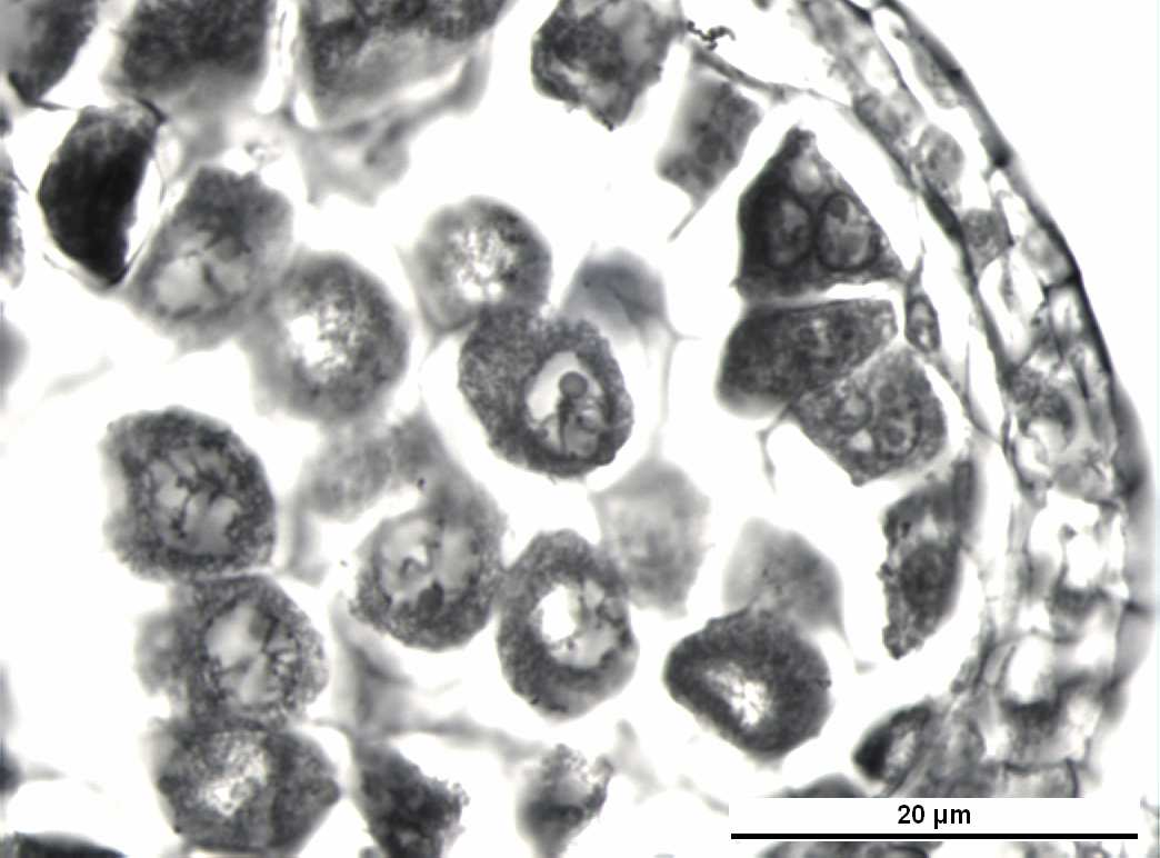 Uslu anterlerindeki polen ana hücresinin çekirdeğinde Profaz-I evresinde organize olamamış kromatin katlanmaları (ok