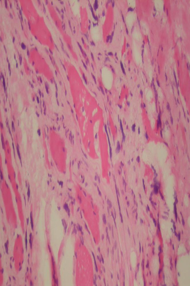 Parafin bloklardan yapılan kesitlerin HE boyalı incelemesinde iri hematoksifilik