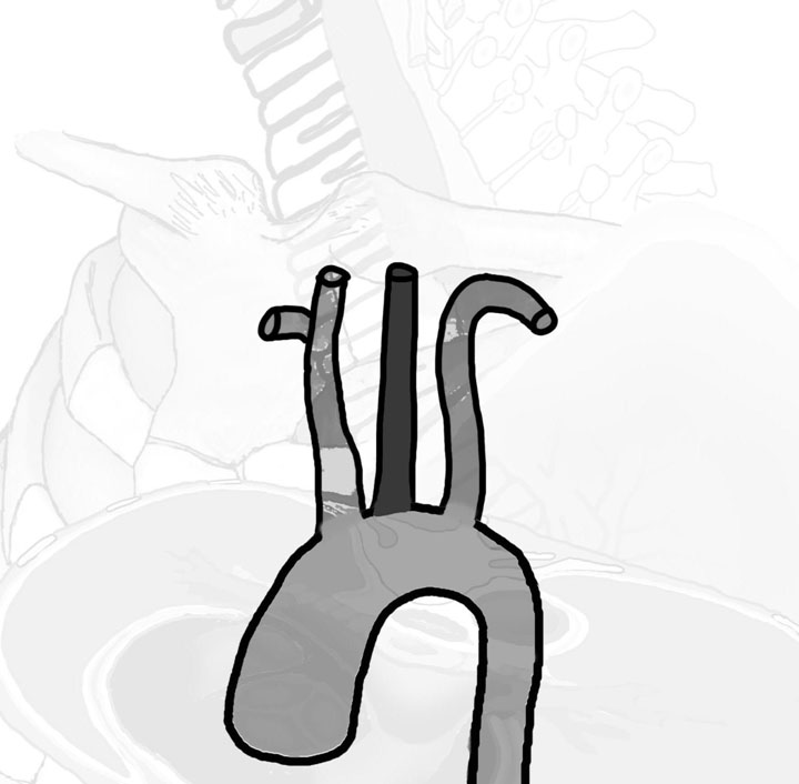Arteria carotis