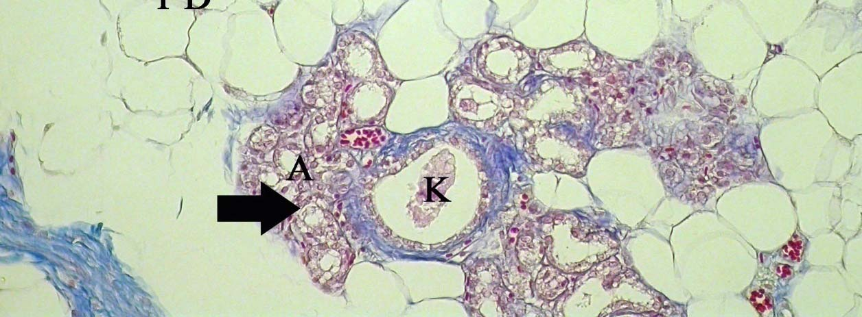 İnterlober ve intralober bağdoku içinde de kan ve lenf damarları ile bağdoku hücreleri bulunmaktaydı. Ayrıca tüm gruplarda meme içine yerleşmiş intramammar lenf düğümü görülmekteydi (Şekil 4.4).