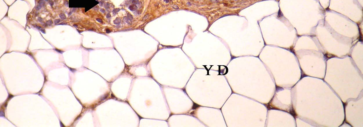 kanal, YD: yağ doku, kanal epitel hücreleri (ok),