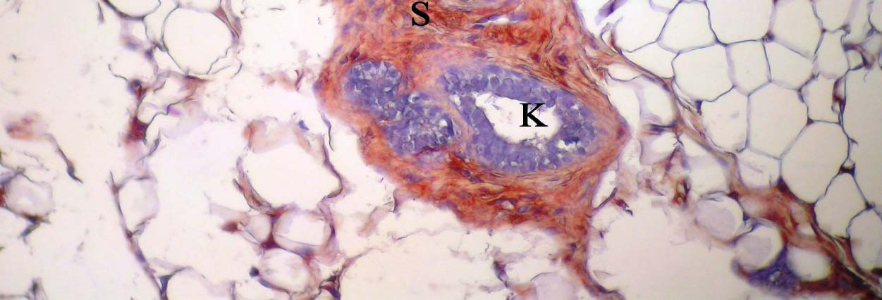 alveol, K: kanal, YD: yağ doku, S: bağdoku,) damar endotel