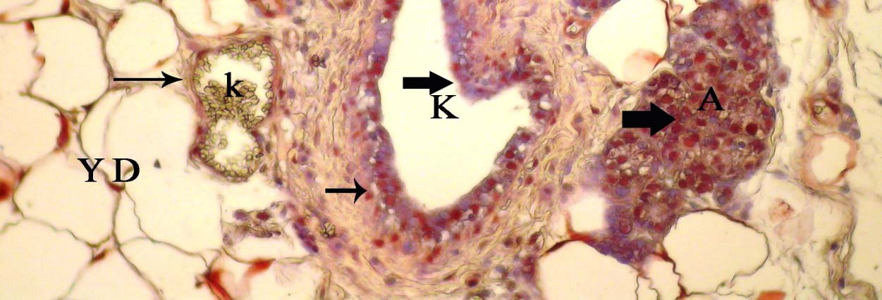 S: bağdoku, YD: yağ doku, k: kan damarı, alveol ve kanal epitel