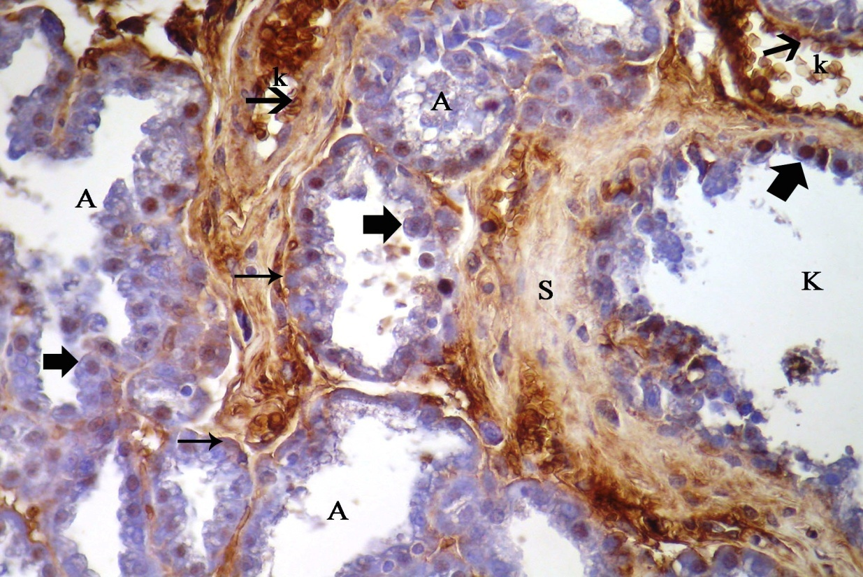 67 Laktasyon döneminde meme: Laktasyon döneminde, erbb1, erbb2, erbb3 ve erbb4 immunoreaktivitesi alveol ve kanal epitel hücreleri, bağdoku ve meme yağ dokusu hücreleri ile miyoepitel hücrelerinin ve