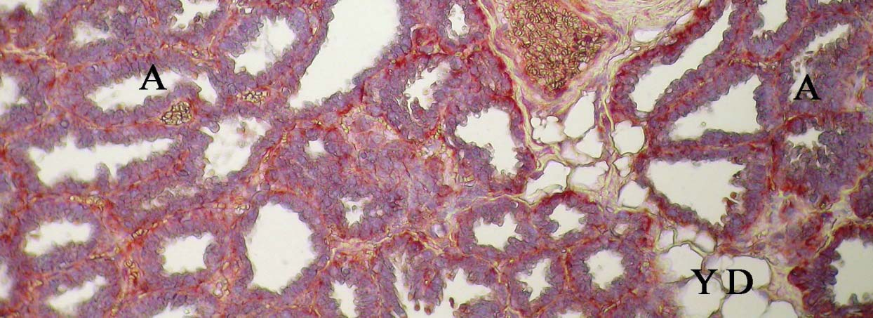 (ince ok), X20 Laktasyon döneminde Flk1 reaksiyonu bağdoku ve meme yağ dokusuna yerleşmiş olan damarların endotel hücrelerinin sitoplazmalarında yerleşmiş olup, lop ve lopçuklar