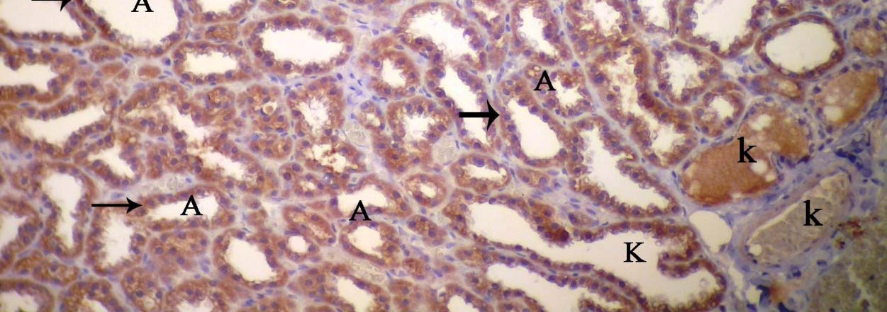 alveol ve kanal epitel hücrelerinde erbb1 ve erbb2 immunreaktivitesi zayıfken (Şekil 4.39, 40), erbb3 ve erbb4 ise daha yoğun olarak gözlendi (Şekil 4.41, 42).