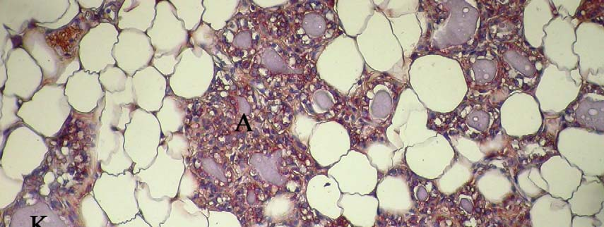 78 İnvolusyon periyodunda VEGF, flt1 ve flt4 immunreaksiyonunun, içleri salgı materyali ile dolu olan alveol epitel hücrelerinde zayıftan kuvvetliye değişen yoğunluklarda olduğu, kanallarda ise bazı