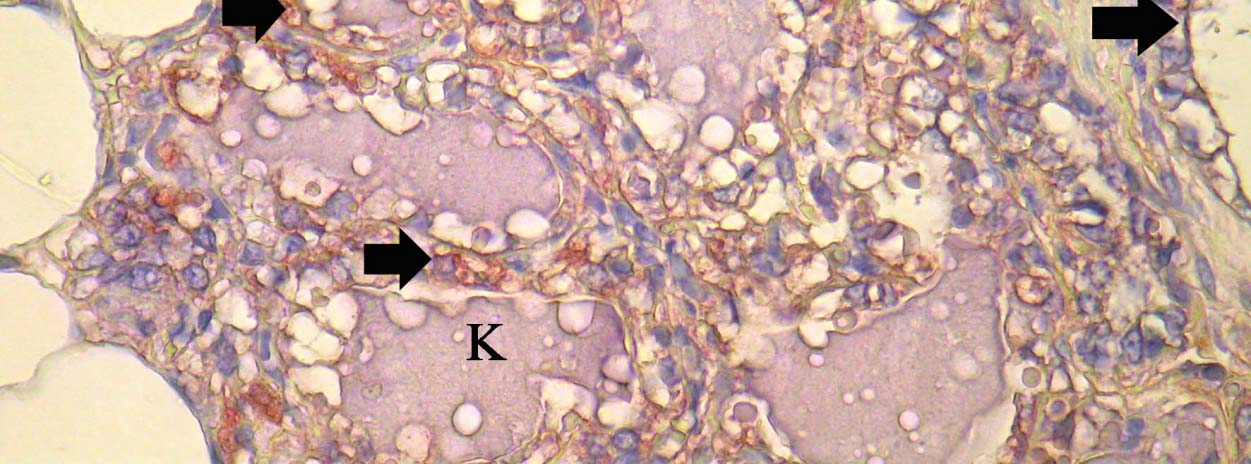 (ok), X40 İnvolusyon döneminde VEGI immunreaksiyonu alveol ve kanal epitelleri ile damar endotel hücrelerinde görüldü.