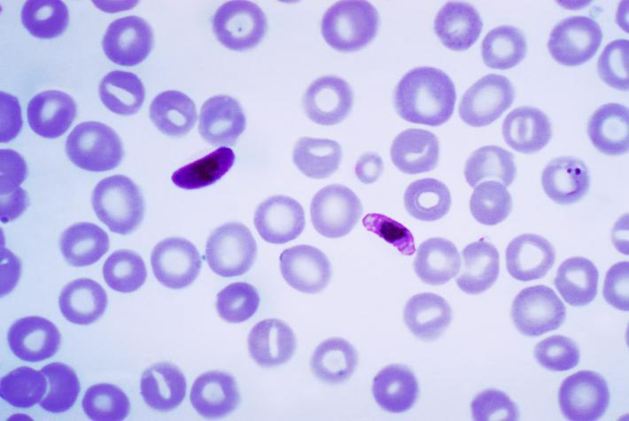 1) Protozoa: Tek hücreli hayvan benzeri protistalardır. 4)Sporlular Spor denilen üreme hücreleri oluşturarak üreme gösterdiklerinden bu isim verilmiştir. En bilinen örneği PLASMODİUMdur.