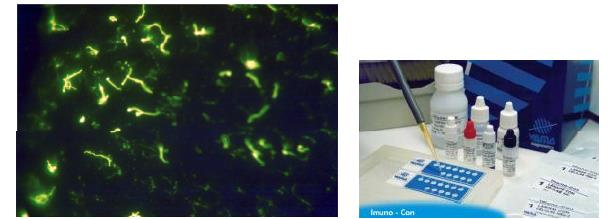 Konjugatın işaretlendiği madde bir florokrom boyasıdır ve değerlendirme floresans mikroskobu ile yapılır.