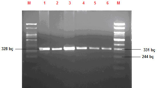 FLT3 geni ITD bölgesi PZR sonrası elde edilen ürün %3 lük agaroz jelde yürütülerek görüntülendi