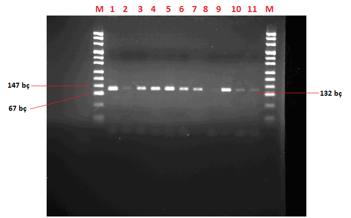 4 FLT3 geni ITD bölgesi PZR sonrası %3'lük jel elektroforezi görüntüsü M: Marker puc FLT3 geni TKD
