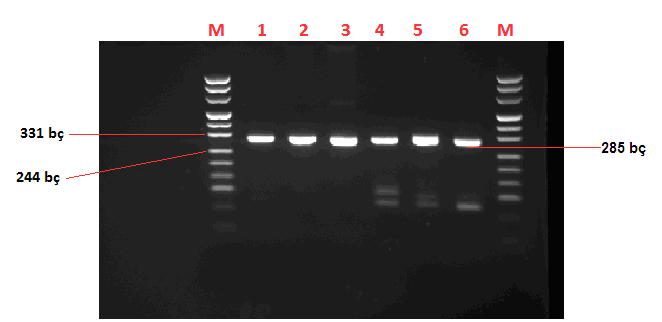 M: Marker puc, pozitif kontrol ve kesime uğramış hasta örnekleri Araştırma kapsamındaki 23 olgunun hiçbirinde FLT3-ITD ve FLT3-TKD mutasyonu