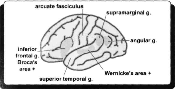 2) Broca konuşma merkezi nerede bulunur? (Nisan- 1994) A) Uncus B) Gyrus postcentralis C) Gyrus preangularis D) Gyrus triangularis E) Gyrus supramarginalis Frontal lobta bulunan önemli alanlar: 4.