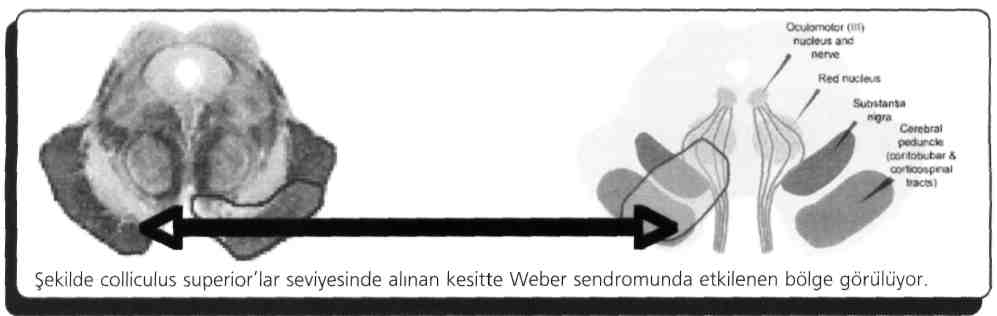 rectus superior Aşağı bakış: m.rectus inferior Yukarı dışa bakış: m.obliquus inferior Aşağı dışa bakış: m.obliquus superior M.obliquus superior (N. IV) ve m.rectus lateralis (N.