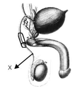 81) Erkeğin genital organlarını gösteren yukarıdaki şekilde "X" ile belirtilen oluşum aşağıda-kilerden hangisidir?
