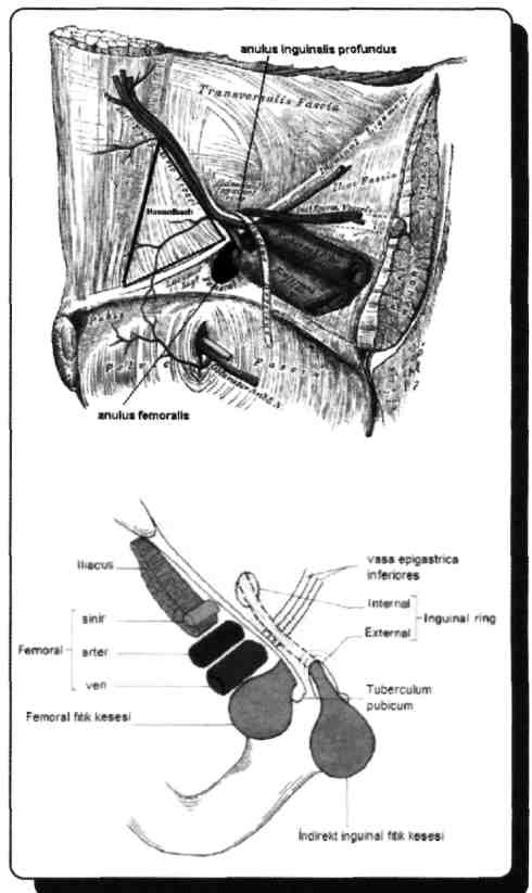 E) Lig. reflexum Linea alba yapısına rectus hariç diğerleri katılır. Lig. inguinale (Poupart) liflerinin devamı symphysis pubis'i dönerler ve lig.