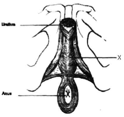 Şekilde - X - ile işaretlenen kas aşağıdakilerden hangisidir? A) M. bulbospongiosus B) M. ischiocavernosus C) M. levator ani D) M. sphincter ani externus E) M.