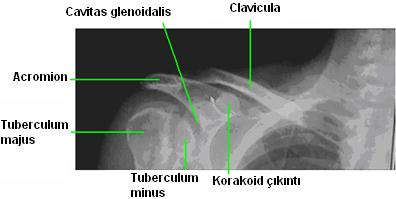 Radyografilerinde Anatomik Yapı Clavicula A-P