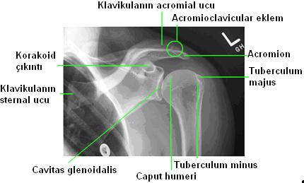 29: Omuz internal radyogramı ve Ģeması (sol) Omuz