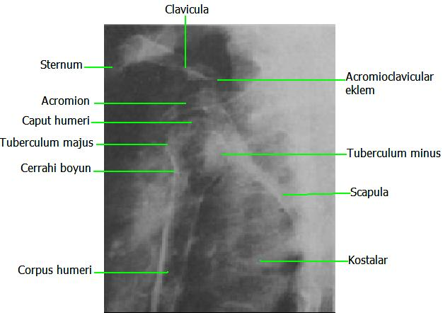 Humerus Transtorasik Radyografisinde Anatomik Yapı Resim 1.
