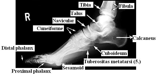 Ayak Lateral Radyografisinde Anatomik Yapı Resim