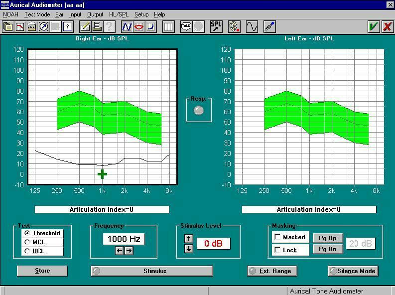 Şekil- 3: İşitme Cihazı Adaptasyonunda Kullanılan SPL Odyogram Örneği Odyometreler tarafından belirlenen, işitme eşiklerinin gösterilmesi amacı ile kullanılan grafiklere odyogram
