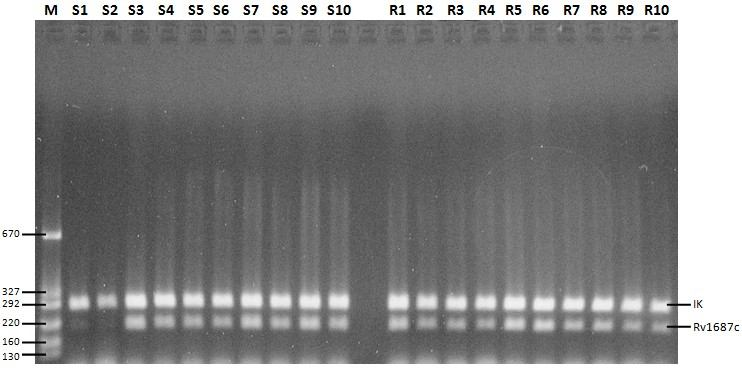 Şekil 4.15. Rv1687c geni 30 döngü PZR fotoğrafı. (M: Moleküler büyüklük belirteci, IK: İnternal kontrol, S1-S10 Duyarlı M.tuberculosis suşları, R1-R10 MDR M.