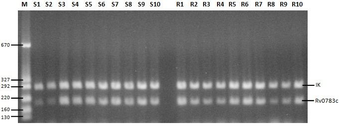 Şekil 4.20. Rv0783c geni 29 döngü PZR fotoğrafı. (M: Moleküler büyüklük belirteci, IK: İnternal kontrol, S1-S10 Duyarlı M.tuberculosis suşları, R1-R10 MDR M.